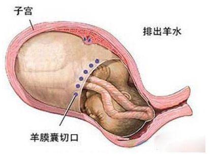 300斤孕妈高危产子,设计策略快速解答_整版DKJ656.74